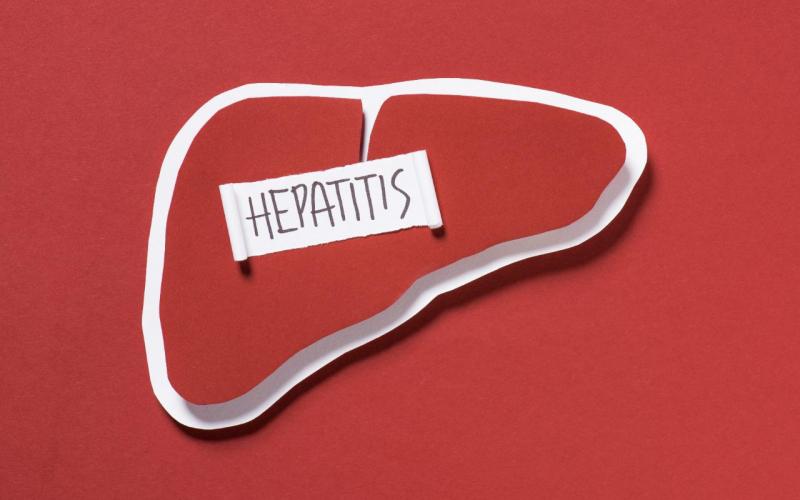 Hepatitis