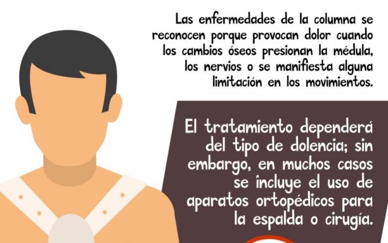 Columna