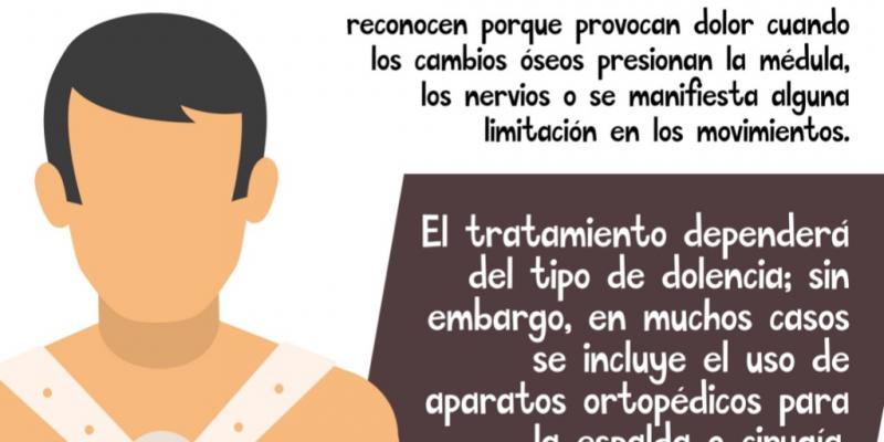 Columna